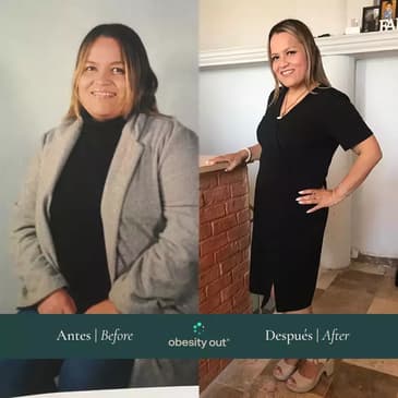 Slider image (9) Obesity Out Bariatric Surgery Center